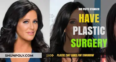 Patti Stanger's Transformation: Plastic Surgery Rumors Explored