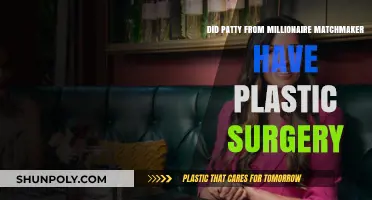 Patty from Millionaire Matchmaker: Plastic Surgery Rumors Explored