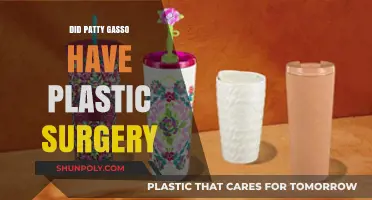 Patty Gasso Plastic Surgery: Fact-Checking the Rumors and Speculations