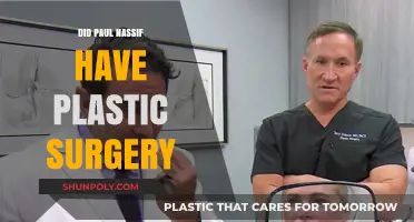 Paul Nassif Plastic Surgery: Fact-Checking the Rumors and Speculations