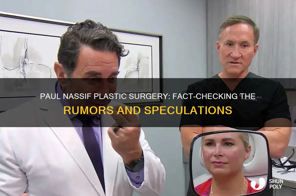 did paul nassif have plastic surgery