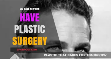 Paul Newman's Timeless Look: Plastic Surgery Speculations Explored