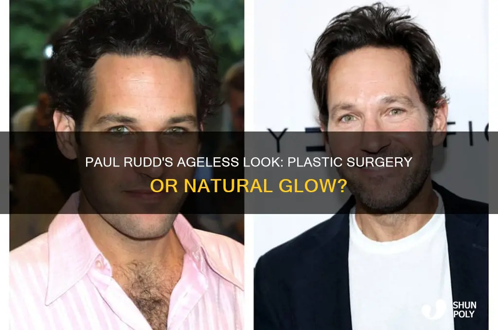 did paul rudd have plastic surgery