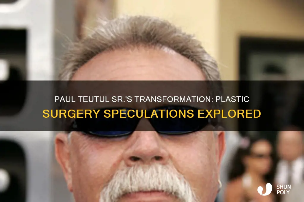 did paul teutul senior have plastic surgery