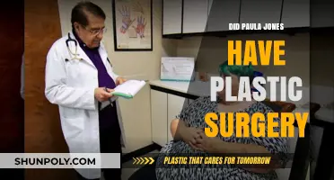 Paula Jones Plastic Surgery: Fact-Checking the Transformation Rumors