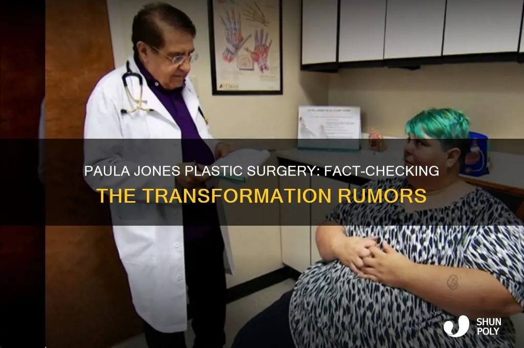 did paula jones have plastic surgery
