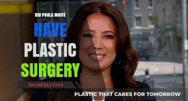 Paula White's Transformation: Plastic Surgery Speculations and Truths Revealed