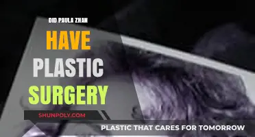 Paula Zhan's Transformation: Plastic Surgery Rumors Explored and Analyzed