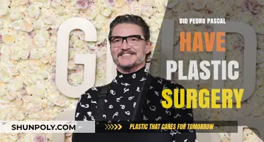 Pedro Pascal Plastic Surgery: Fact-Checking the Transformation Rumors
