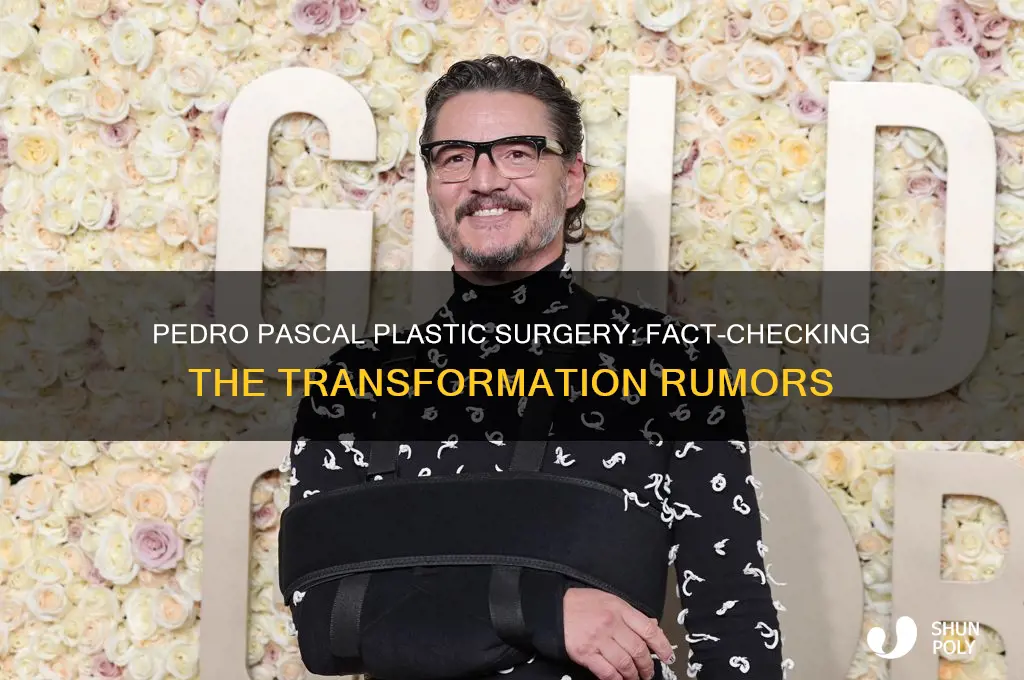 did pedro pascal have plastic surgery