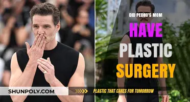 Pedro's Mom's Transformation: Plastic Surgery Speculations and Truths