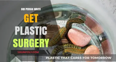 Persia White's Transformation: Plastic Surgery Rumors Explored