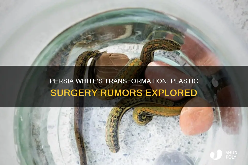 did persia white get plastic surgery