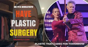 Peta Murgatroyd's Transformation: Plastic Surgery Speculations and Truths