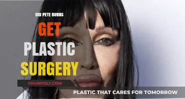 Pete Burns' Transformation: Unveiling the Truth About His Plastic Surgery