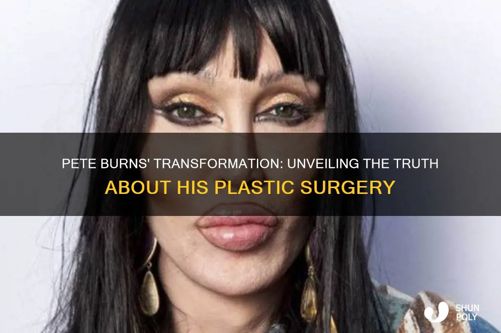 did pete burns get plastic surgery