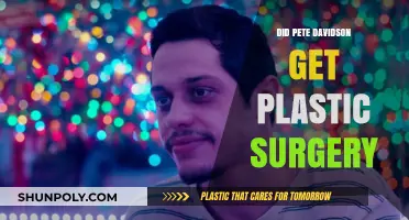Pete Davidson's Transformation: Plastic Surgery Rumors Explored and Debunked
