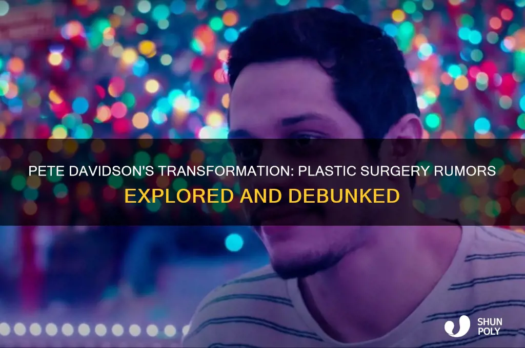 did pete davidson get plastic surgery