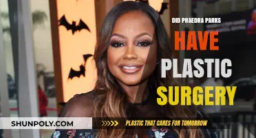 Phaedra Parks Plastic Surgery: Fact-Checking the Rumors and Speculations