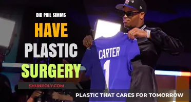 Phil Simms Plastic Surgery: Fact-Checking the Rumors and Speculations