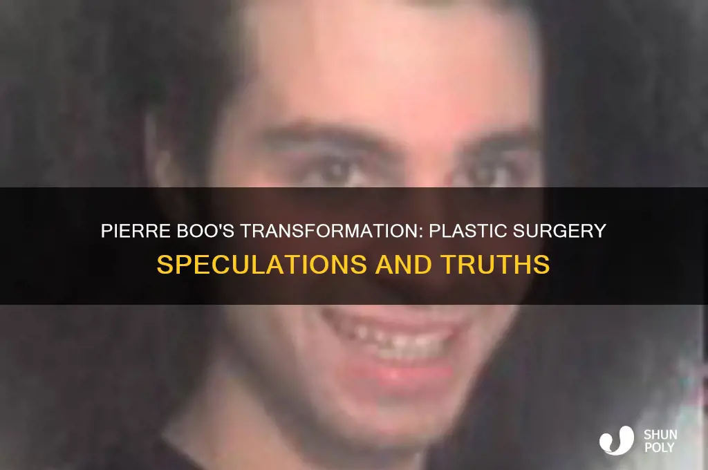 did pierre boo get plastic surgery