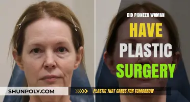 Did Pioneer Woman Ree Drummond Undergo Plastic Surgery? The Truth Revealed