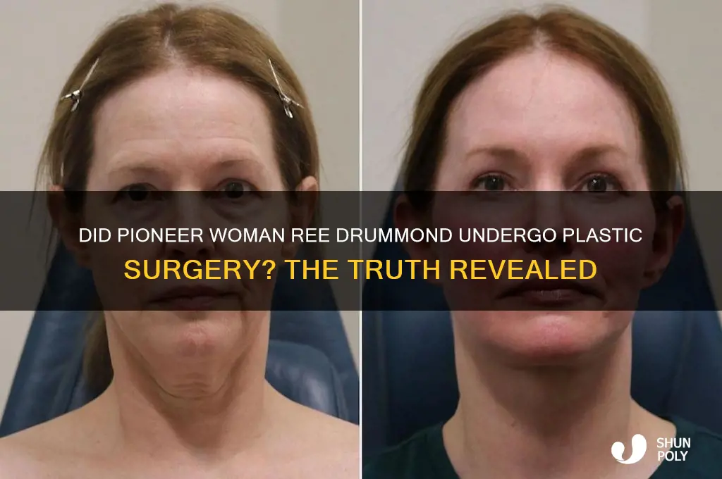 did pioneer woman have plastic surgery