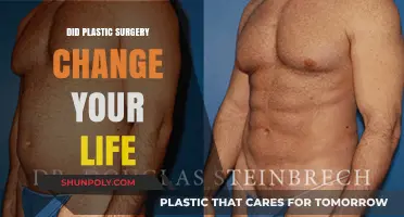 Plastic Surgery: Life-Changing Transformation or Just a New Look?