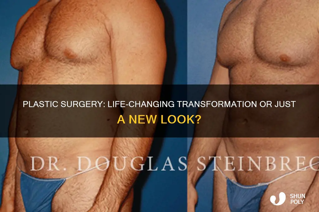 did plastic surgery change your life