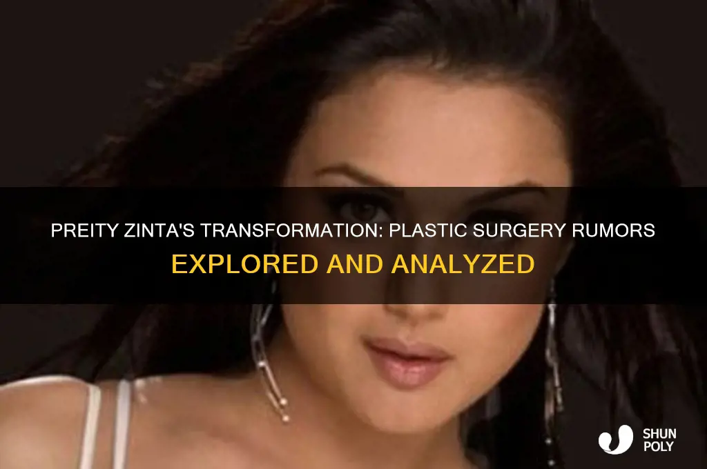 did preity zinta get plastic surgery