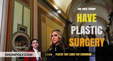 Did Trump Undergo Plastic Surgery? Examining the Rumors and Evidence