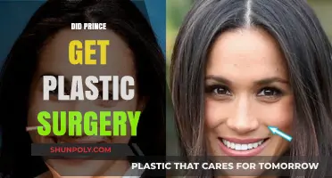 Prince's Transformation: Unveiling the Truth About His Plastic Surgery Rumors