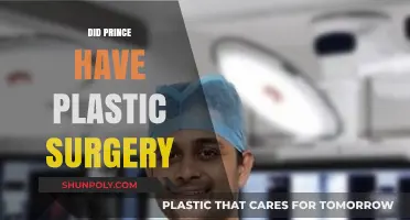Unveiling Prince's Transformation: Plastic Surgery Rumors Explored