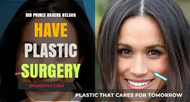 Prince Rogers Nelson: Plastic Surgery Rumors and the Truth Behind Them