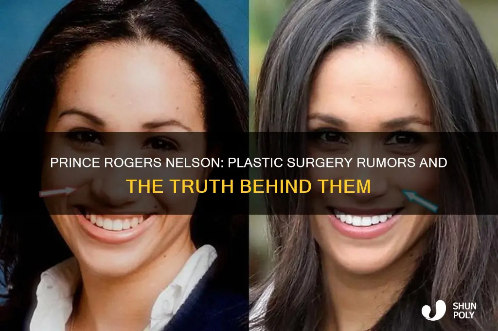 did prince rogers nelson have plastic surgery