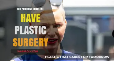 Princess Charlene's Transformation: Plastic Surgery Speculations and Truths Revealed