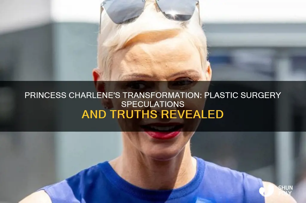 did princess charlene have plastic surgery