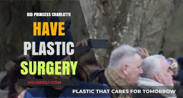 Princess Charlotte Plastic Surgery Rumors: Fact or Fiction?