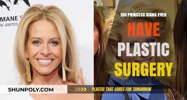 Unveiling the Truth: Did Princess Diana Undergo Plastic Surgery?