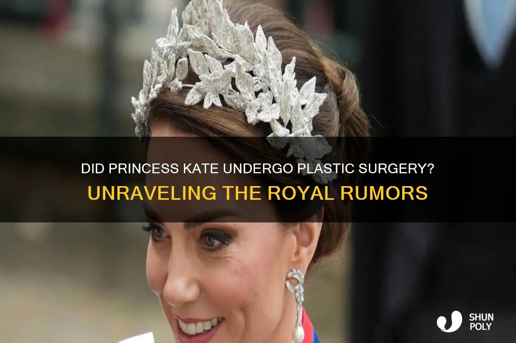 did princess kate get plastic surgery