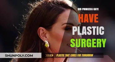 Did Princess Kate Undergo Plastic Surgery? Unveiling the Royal Truth