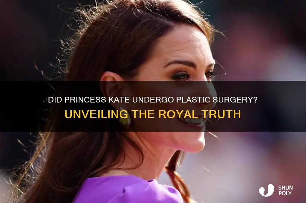 did princess kate have plastic surgery