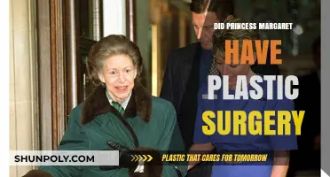 Princess Margaret's Beauty Secrets: Plastic Surgery Rumors Explored