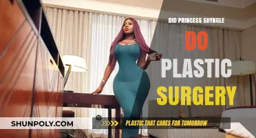 Princess Shyngle's Transformation: Plastic Surgery Rumors Explored