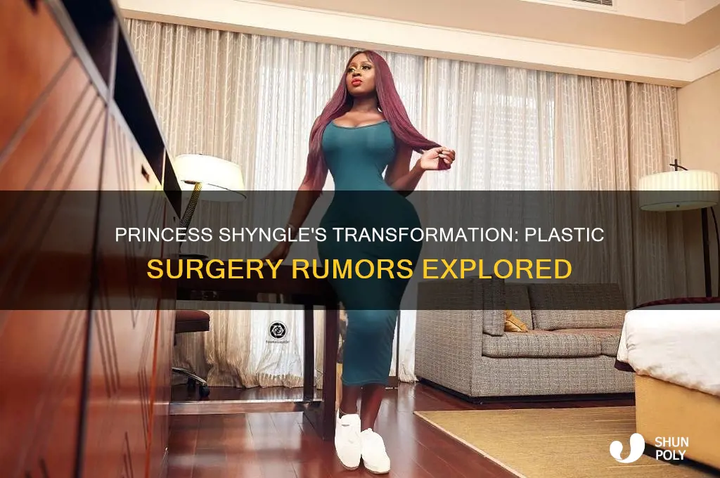 did princess shyngle do plastic surgery