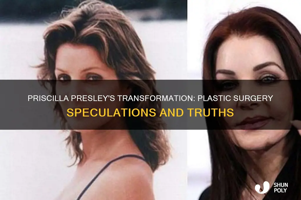 did priscilla presley get plastic surgery