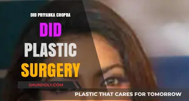 Priyanka Chopra's Transformation: Plastic Surgery Rumors Explored