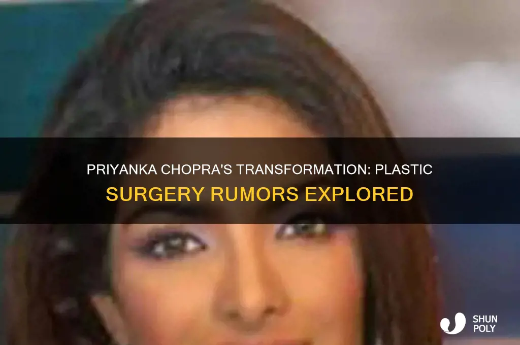 did priyanka chopra did plastic surgery