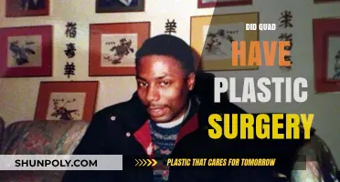 Quad Webb's Transformation: Plastic Surgery Speculations and Truths Revealed