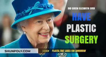 Queen Elizabeth II: Plastic Surgery Rumors and Royal Reality